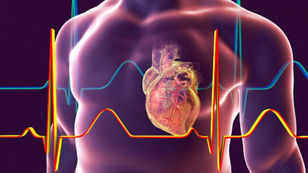 Qué enfermedades cardiovasculares se pueden desarrollar a causa del COVID-19